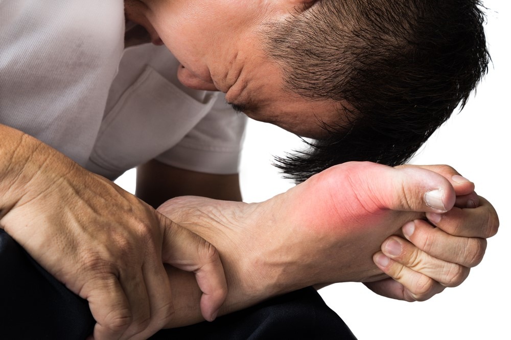 Bệnh gout gây ra những cơn đau khó chịu