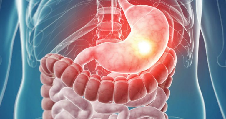 viral-gastroenteritis-background-pathophysiology-etiology