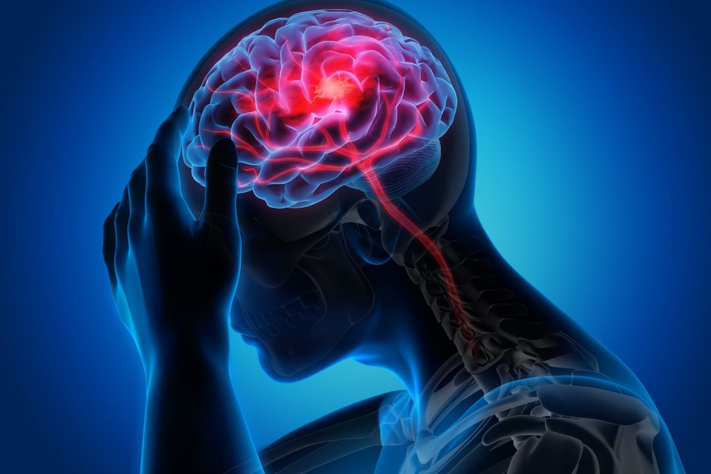 Lao màng não: Bệnh lý hiếm gặp có khả năng tử vong cao