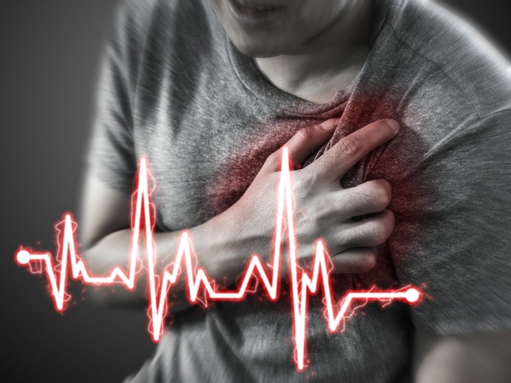 Nhồi máu cơ tim là nguy cơ gây hở van hai lá