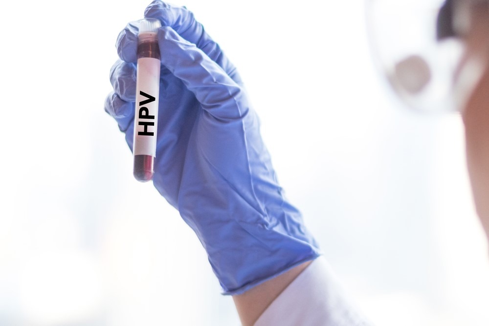 Virus HPV có thể điều trị dứt điểm hay không?